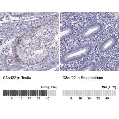 <b>Orthogonal Strategies Validation. </b>Immunohistochemistry-Paraffin: C3orf22 Antibody [NBP2-31754] - Staining in human testis and endometrium tissues using anti-C3orf22 antibody. Corresponding C3orf22 RNA-seq data are presented for the same tissues.