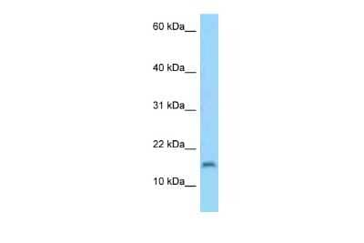 Western Blot: C3orf22 Antibody [NBP2-82898] - WB Suggested Anti-C3orf22 Antibody. Titration: 1.0 ug/ml. Positive Control: HepG2 Whole Cell