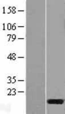 Western Blot: C3orf22 Overexpression Lysate (Adult Normal) [NBL1-08438] Left-Empty vector transfected control cell lysate (HEK293 cell lysate); Right -Over-expression Lysate for C3orf22.