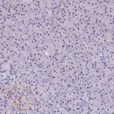 Immunohistochemistry-Paraffin CMSS1 Antibody - BSA Free