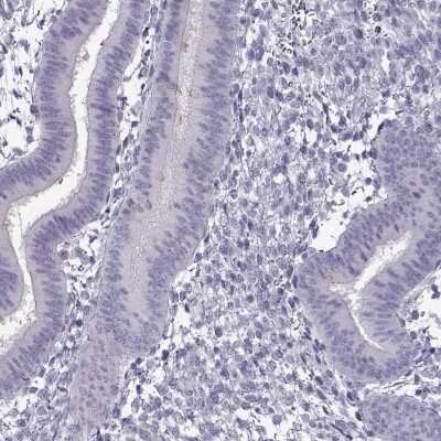 Immunohistochemistry-Paraffin: C3orf30 Antibody [NBP2-37991] - Staining of human endometrium shows low expression as expected.