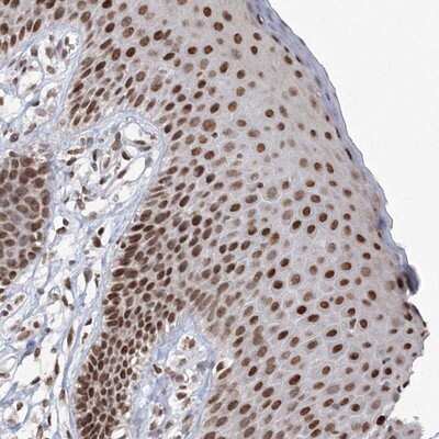 Immunohistochemistry-Paraffin: C3orf33 Antibody [NBP1-90874] - Staining of human vulva/anal skin shows strong nuclear positivity in squamous epithelial cells.