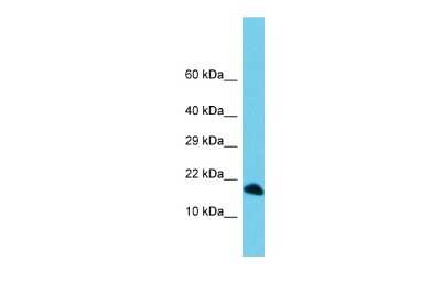 Western Blot: C3orf36 Antibody [NBP2-84558] - Host: Rabbit. Target Name: C3orf36. Sample Type: 721_B Whole Cell lysates. Antibody Dilution: 1.0ug/mlC3orf36 is supported by BioGPS gene expression data to be expressed in 721_B