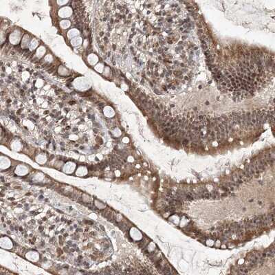 Immunohistochemistry-Paraffin C3orf38 Antibody - BSA Free