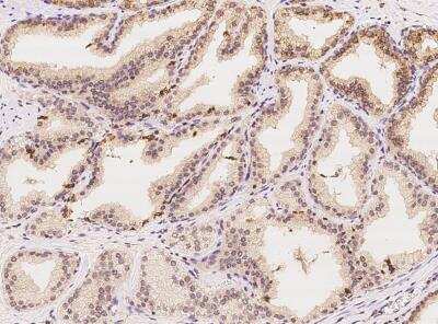 Immunohistochemistry-Paraffin: C3orf38 Antibody [NBP3-06505] - Staining of human C3orf38 in human prostate with rabbit polyclonal antibody at 1:100 dilution.
