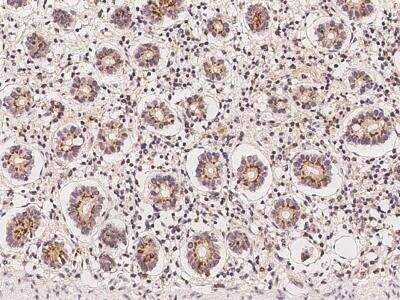 Immunohistochemistry-Paraffin: C3orf38 Antibody [NBP3-06505] - Staining of human C3orf38 in human small intestine with rabbit polyclonal antibody at 1:100 dilution.