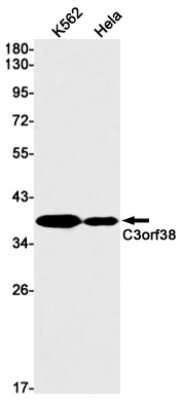 Western Blot: C3orf38 Antibody (S08-3H6) [NBP3-15009] - Western blot detection of C3orf38 in K562, Hela cell lysates using C3orf38 Rabbit mAb (1:1000 diluted). Predicted band size: 38kDa. Observed band size: 38kDa.