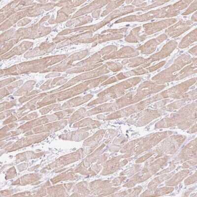 Immunohistochemistry: C3orf49 Antibody [NBP2-49091] - Staining of human heart muscle shows moderate cytoplasmic positivity in myocytes.