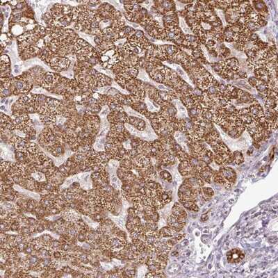 Immunohistochemistry-Paraffin: C3orf55 Antibody [NBP2-14781] - Staining of human liver shows strong cytoplasmic positivity in hepatocytes and bile duct cells.
