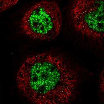 Immunocytochemistry/Immunofluorescence: C3orf62 Antibody [NBP1-81899] - Staining of human cell line A-431 shows localization to nuclear speckles. Antibody staining is shown in green.