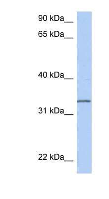 Western Blot: C3orf62 Antibody [NBP1-70473] - MCF-7 whole cell lysates, concentration 0.2-1 ug/ml.