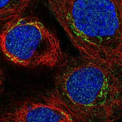 Immunocytochemistry/Immunofluorescence: C3orf67 Antibody [NBP2-57722] - Staining of human cell line A-431 shows localization to nucleus & the Golgi apparatus.