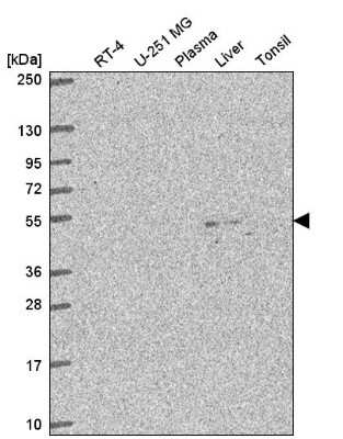 Western Blot: C3orf67 Antibody [NBP2-57722] - Analysis in human cell line RT-4, human cell line U-251 MG, human plasma, human liver tissue and human tonsil tissue.