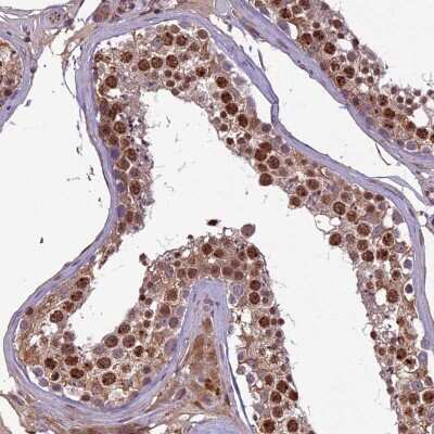 Immunohistochemistry-Paraffin C3orf70 Antibody - BSA Free