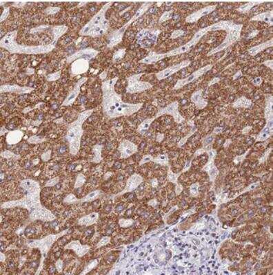 Immunohistochemistry TOPAZ1 Antibody - BSA Free