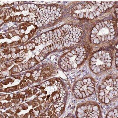 Immunohistochemistry: C3orf77 Antibody [NBP2-30863] - Staining of human stomach, upper shows strong cytoplasmic and membranous positivity in glandular cells.