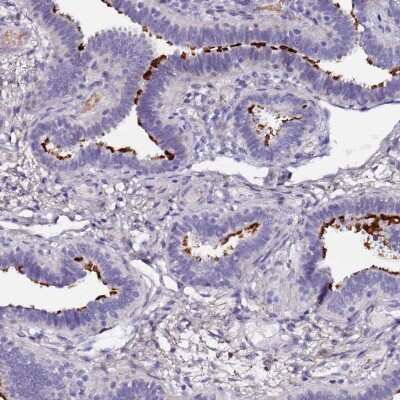 Immunohistochemistry-Paraffin: C3orf80 Antibody [NBP2-48872] - Staining of human fallopian tube shows strong positivity in cilia of glandular cells.