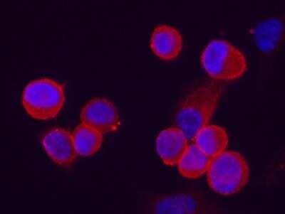 Immunocytochemistry/Immunofluorescence: C4.4A/LYPD3 Antibody (213) [NBP2-89995] - Staining of Human LYPD3 in PC3 cells. Cells were fixed with 4% PFA, blocked with 10% serum, and incubated with rabbit anti-Human LYPD3 monoclonal antibody (1:60) at 37? 1 hour. Then cells were stained with the Alexa Fluor® 594-conjugated goat Anti-rabbit IgG secondary antibody (red) and counterstained with DAPI (blue). Positive staining was localized to cells membrane.