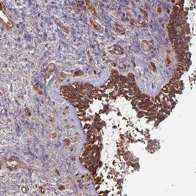 Immunohistochemistry-Paraffin: C4 binding protein B Antibody [NBP2-14412] - Staining of human nasopharynx shows strong cytoplasmic positivity in respiratory epithelial cells.