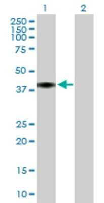 Western Blot: C4 binding protein B Antibody [H00000725-B01P] - Analysis of C4BPB expression in transfected 293T cell line by C4BPB polyclonal antibody.  Lane 1: C4BPB transfected lysate(27.72 KDa). Lane 2: Non-transfected lysate.