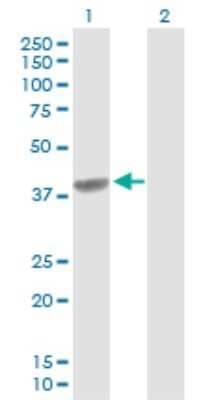 Western Blot: C4 binding protein B Antibody [H00000725-D01P] - Analysis of C4BPB expression in transfected 293T cell line by C4BPB polyclonal antibody.Lane 1: C4BPB transfected lysate(28.40 KDa).Lane 2: Non-transfected lysate.