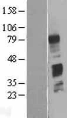 Western Blot C4 binding protein B Overexpression Lysate
