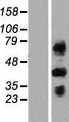 Western Blot C4 binding protein B Overexpression Lysate