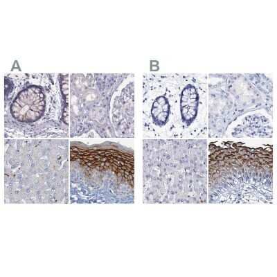 <b>Independent Antibodies Validation. </b>Immunohistochemistry-Paraffin: C4.4A/LYPD3 Antibody [NBP2-32598] - Staining of human colon, kidney, liver and skin using Anti-LYPD3 antibody NBP2-32598 (A) shows similar protein distribution across tissues to independent antibody NBP2-32605 (B).