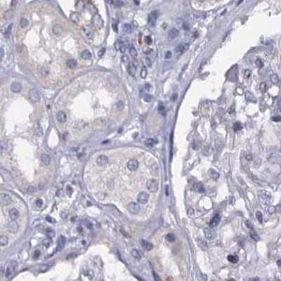 Immunohistochemistry-Paraffin: C4.4A/LYPD3 Antibody [NBP2-32598] - Staining of human kidney.