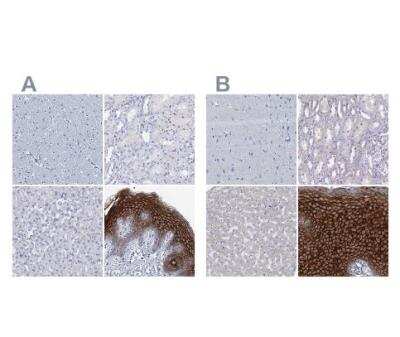 <b>Independent Antibodies Validation and Orthogonal Strategies Validation.</b>Immunohistochemistry-Paraffin: C4.4A/LYPD3 Antibody [NBP2-32605] - Staining of human cerebral cortex, kidney, liver and skin using Anti-LYPDS  andibody NBP2-32605 (A) shows similar protein distribution across tissues to independent antibody (B).