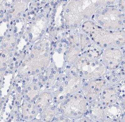 Immunohistochemistry-Paraffin: C4.4A/LYPD3 Antibody [NBP2-32605] - Staining of human kidney shows no positivity in cells in tubules as expected.