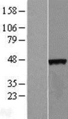 Western Blot: C4orf17 Overexpression Lysate (Adult Normal) [NBL1-08463] Left-Empty vector transfected control cell lysate (HEK293 cell lysate); Right -Over-expression Lysate for C4orf17.