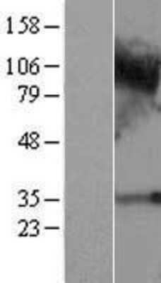 Western Blot C4orf19 Overexpression Lysate