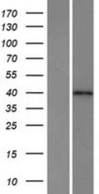 Western Blot: C4orf27 Overexpression Lysate (Adult Normal) [NBP2-06907] Left-Empty vector transfected control cell lysate (HEK293 cell lysate); Right -Over-expression Lysate for C4orf27.
