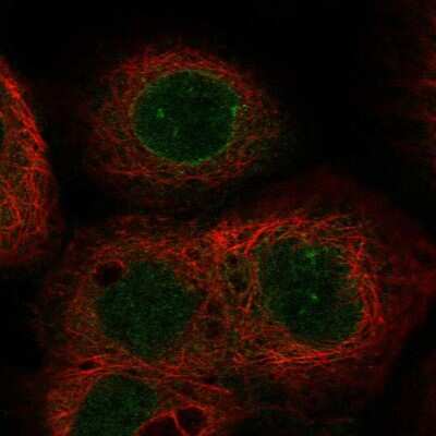 Immunocytochemistry/ Immunofluorescence ABHD18 Antibody - BSA Free