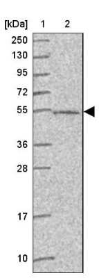 Western Blot ABHD18 Antibody - BSA Free