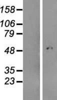 Western Blot: ABHD18 Overexpression Lysate [NBL1-08470] - Left-Empty vector transfected control cell lysate (HEK293 cell lysate); Right -Over-expression Lysate for C4orf29.