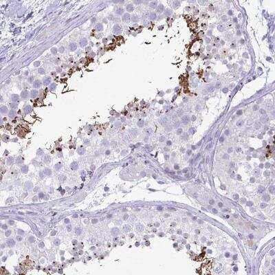 Immunohistochemistry-Paraffin: C4orf33 Antibody [NBP2-32585] - Staining of human testis shows  strong cytoplasmic positivity in spermatids and spermatozoa.
