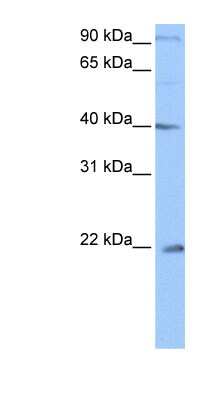 Western Blot: C4orf33 Antibody [NBP1-57846] - Jurkat cell lysate, concentration 0.2-1 ug/ml.
