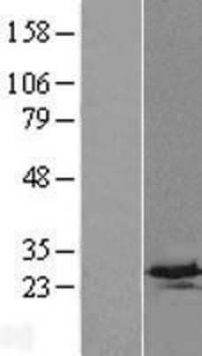 Western Blot: C4orf33 Overexpression Lysate (Adult Normal) [NBP2-09321] Left-Empty vector transfected control cell lysate (HEK293 cell lysate); Right -Over-expression Lysate for C4orf33.