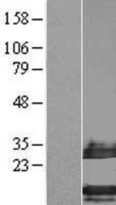Western Blot: C4orf34 Overexpression Lysate (Adult Normal) [NBL1-08475] Left-Empty vector transfected control cell lysate (HEK293 cell lysate); Right -Over-expression Lysate for C4orf34.