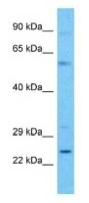 Western Blot: C4orf45 Antibody [NBP3-09655] - Western blot analysis of C4orf45 in Hela Whole Cell lysates. Antibody dilution at 1.0ug/ml