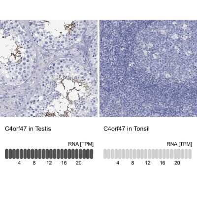 Immunocytochemistry/Immunofluorescence: C4orf47 Antibody [NBP3-17122] - Analysis in human testis and tonsil tissues using Anti-C4orf47 antibody. Corresponding C4orf47 RNA-seq data are presented for the same tissues.