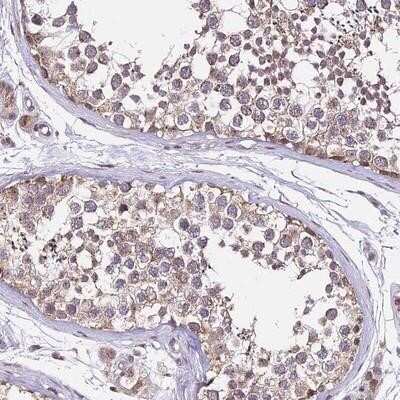 Immunohistochemistry-Paraffin: C4orf47 Antibody [NBP1-93540] - Staining of human testis shows moderate cytoplasmic positivity in cells in seminiferus ducts.