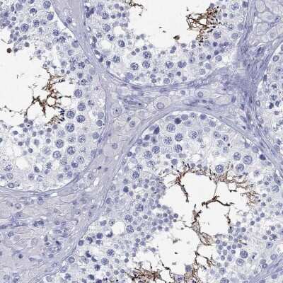 Immunohistochemistry-Paraffin: C4orf47 Antibody [NBP3-17122] - Staining of human testis shows high expression.