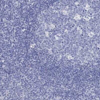 Immunohistochemistry-Paraffin: C4orf47 Antibody [NBP3-17122] - Staining of human tonsil shows low expression as expected.