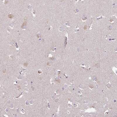 Immunohistochemistry-Paraffin: C4orf48 Antibody [NBP2-30706] - Staining of human cerebral cortex shows weak cytoplasmic positivity in neurons.