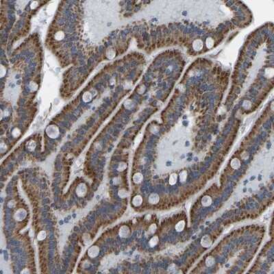 Immunohistochemistry-Paraffin: C4orf52 Antibody [NBP1-90942] - Staining of human duodenum shows strong cytoplasmic positivity in granular pattern in glandular cells.