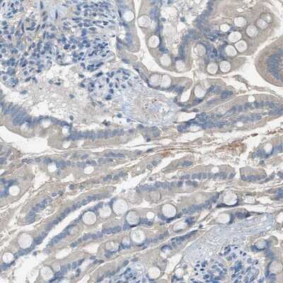 Immunohistochemistry-Paraffin: C5L2/GPR77 Antibody [NBP1-86777] - Staining of human small intestine shows distinct positivity in subset of glandular cells.