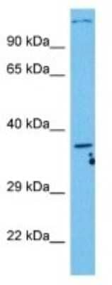 Western Blot: C5L2/GPR77 Antibody [NBP3-10811] - Western blot analysis of C5L2/GPR77 in Human Du145 Whole Cell lysates. Antibody dilution at 1ug/ml